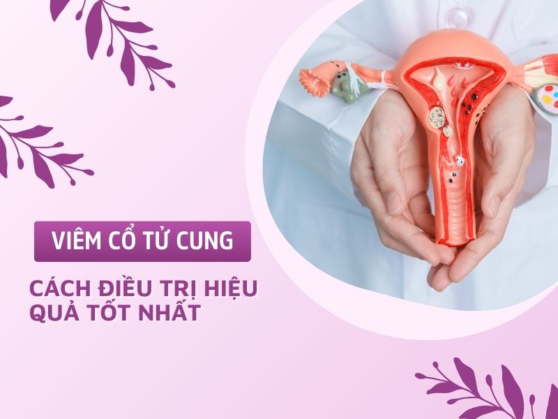 Viêm cổ tử cung