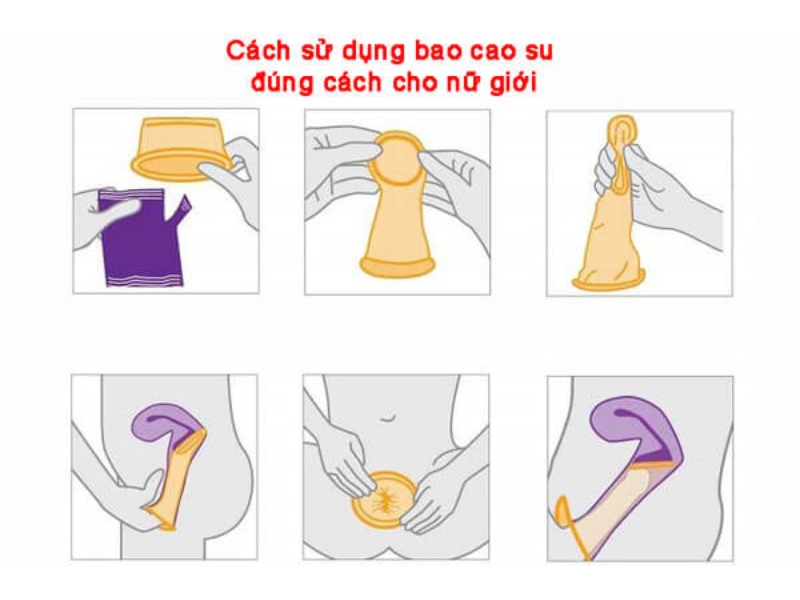 Cách sử dụng bao cao su nữ