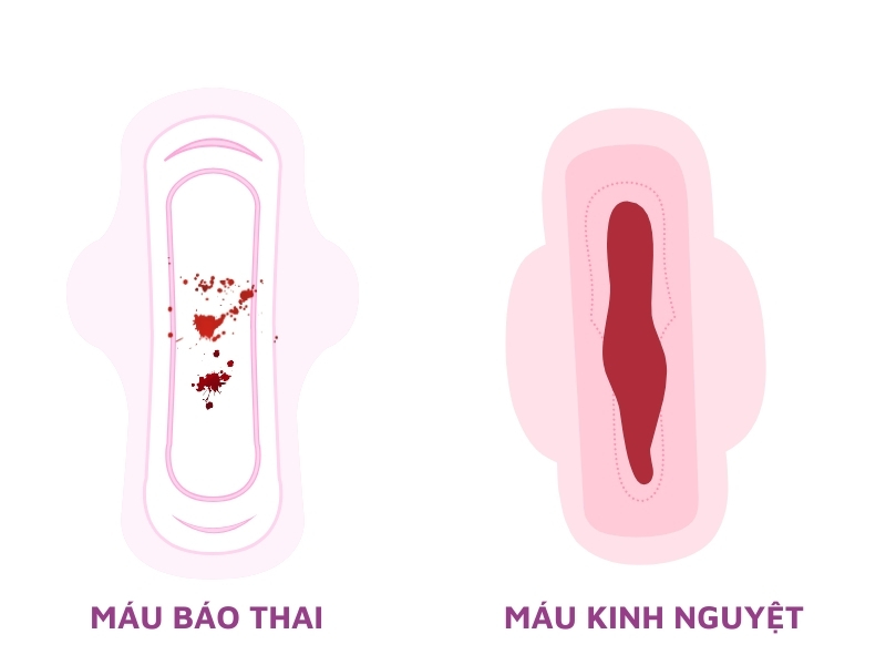 Sự khác biệt giữa máu báo thai và kinh nguyệt