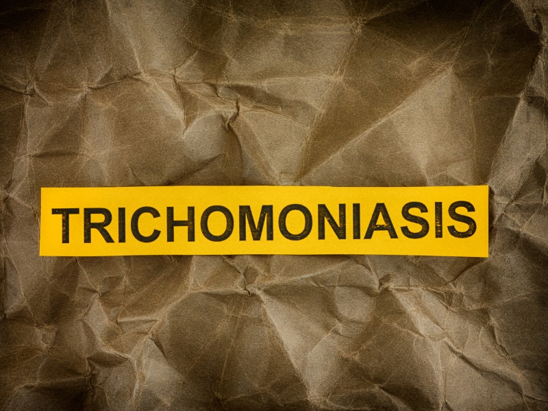 Trichomoniasí - Bệnh lây truyền qua đường tình dục cần lưu ý